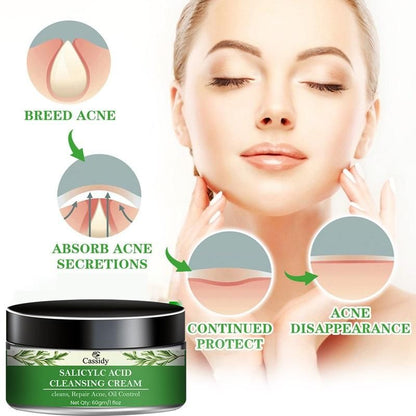 CASSIDY Salicylc Acid Cleansing Cream, 60gm (Pack Of 1)